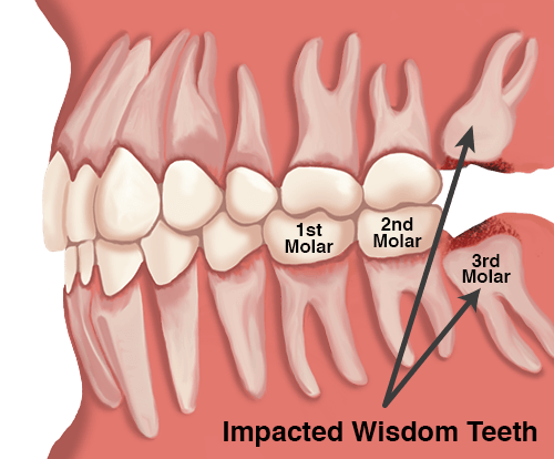 دندانهای انسان